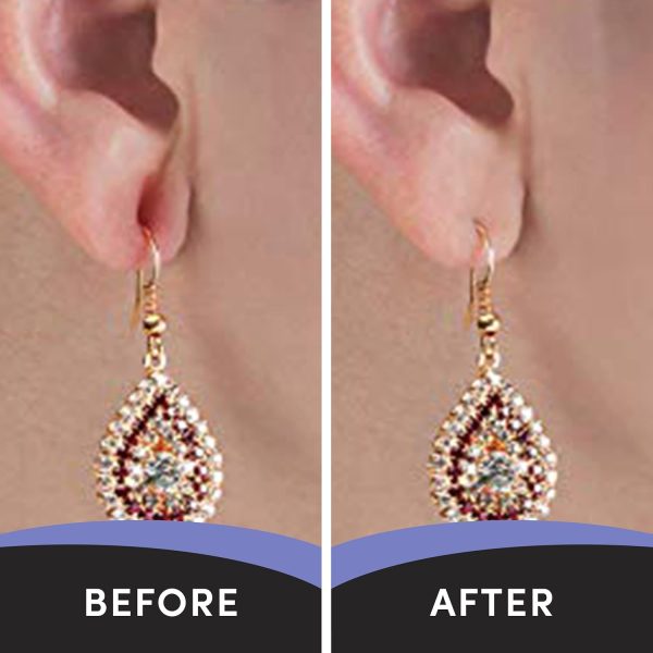 Lobe Miracle- Clear Earring Support Patches - Earring Backs For Droopy Ears - Ear Care Products for Torn or Stretched Ear Lobes (60 Patches)-3